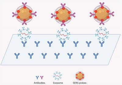 Advances in the Application of Exosomes Identification Using Surface-Enhanced Raman Spectroscopy for the Early Detection of Cancers